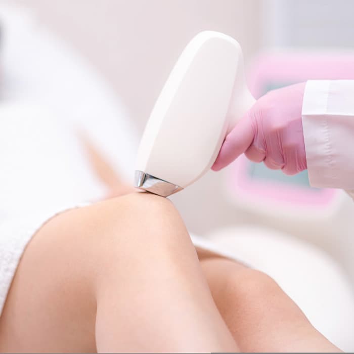 zabieg depilacji laserowej