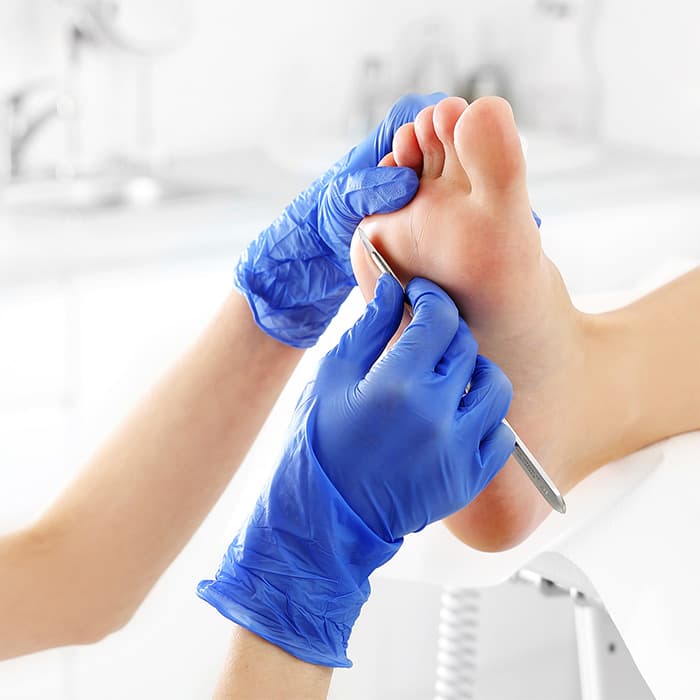 Stopa podczas zabiegu podologii 